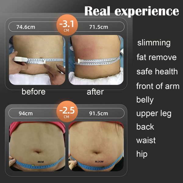 6 in 1 120K Ultrasonic Rf Cavitation Vacuum Rf body slimming machine laser lipo weight loss cellulite removal body sculpting - Image 5