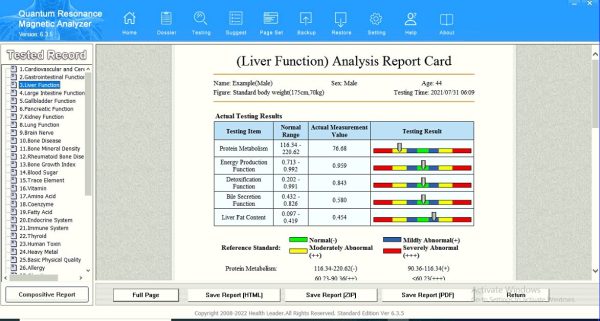 23G+ INDIAS ULTINO-PRO® Quantum Resonance Magnetic Analyzer Full Body Check-Up Machine (New Latest Version), Silver (HAND+FINGER SENSOR) - Image 6